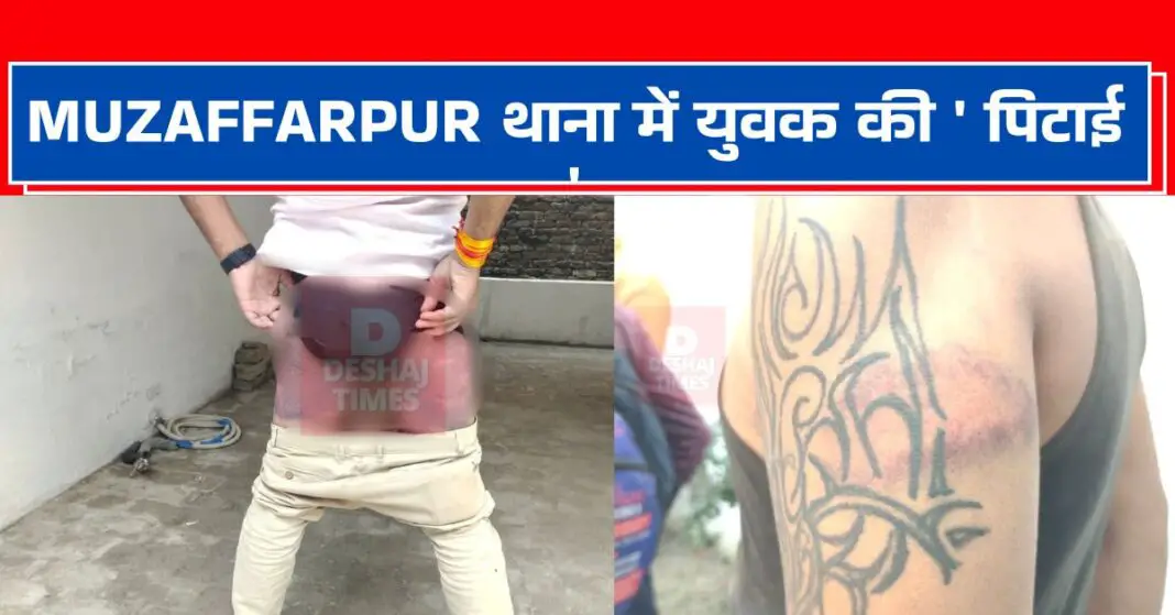 A young man was 'beaten up' in Muzaffarpur police station, first his brother-in-law was caught, then his brother-in-law was locked in the lock-up and beaten brutally, now BHRC, NHRC? DeshajTimes.Com