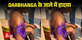 Darbhanga के जाले में बिजली का झटका लगने से कर्मी झुलसा, DMCH रेफर