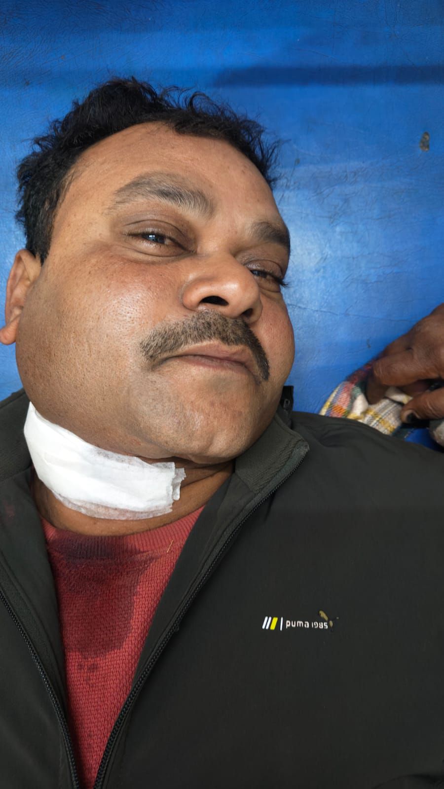 Kahalgaon News: दिनदहाड़े डीलर के गले पर चाकू घोंपा, बाइक से पहुंचे थे हमलावर