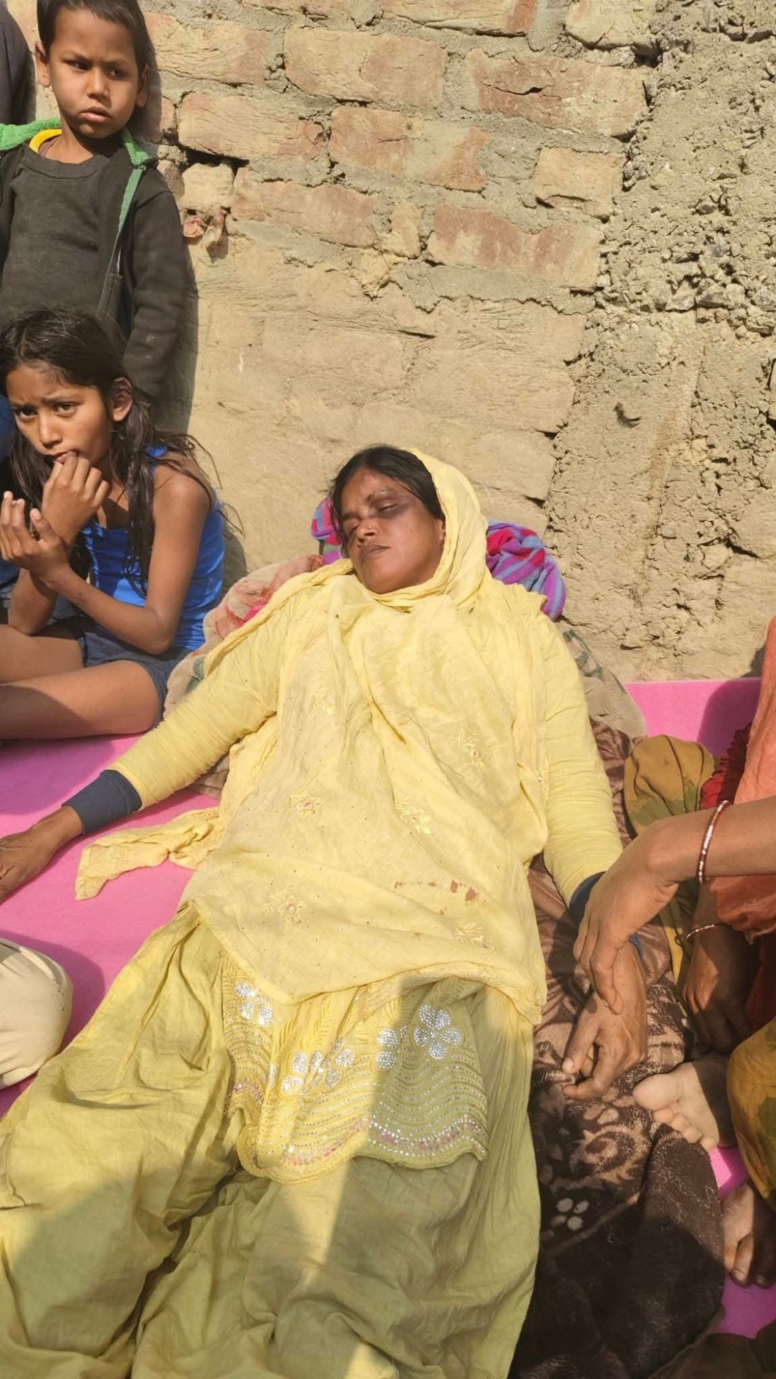 Araria News: Domestic Violence: पति-ससुर बने हैवान, हाथ-पैर बांधकर महिला को कुल्हाड़ी से पीटा, हालत गंभीर | Deshaj Times Araria News: Domestic Violence: पति-ससुर बने हैवान, हाथ-पैर बांधकर महिला को कुल्हाड़ी से पीटा, हालत गंभीर