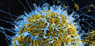 Ebola Contagious Disease : इबोला वायरस का कहर: WHO ने घोषित की अंतरराष्ट्रीय आपातकाल, जानें क्या है खतरा?