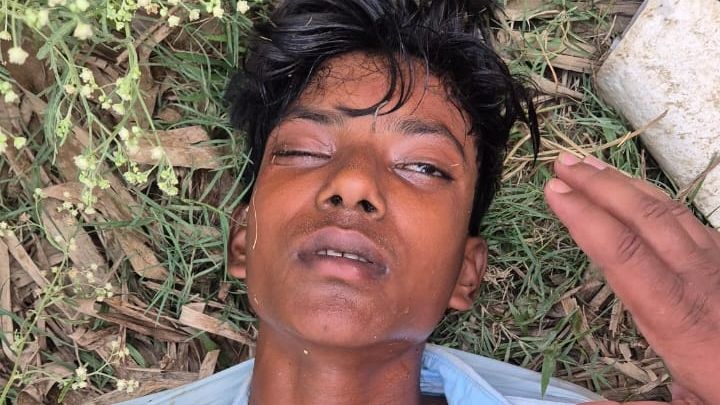 Darbhanga News: दरभंगा NH 527B पर दर्दनाक Bike Accident, महिला समेत बाइक सवार गंभीर घायल, DMCH रेफर
