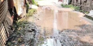 Bhagalpur Nagar Nigam News: भागलपुर: वार्ड 39 की सड़क बनी नरक! नाले का पानी और जर्जर तार दे रहे बीमारियों को न्योता